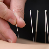 1st Choice Acupuncture A.